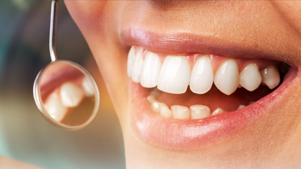 Tratamiento de ortodoncia integrativa para alinear dientes y mejorar la salud dental.